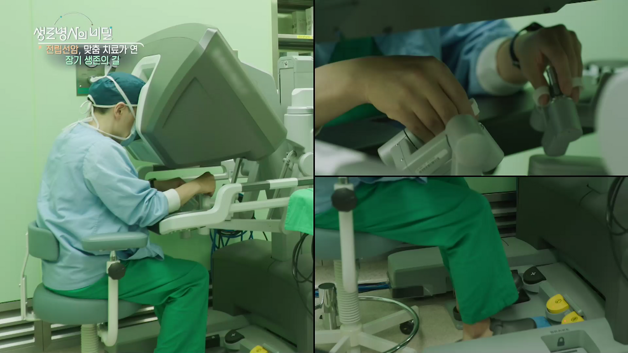 생로병사의 비밀 전립선암