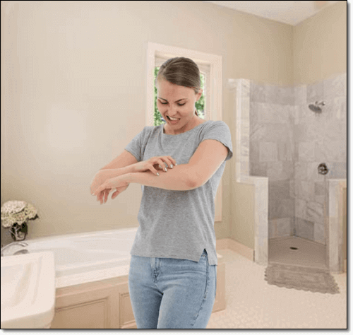 차빌 알레르기 여성