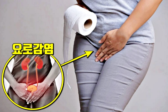 여자 요로감염 증상 원인,건강