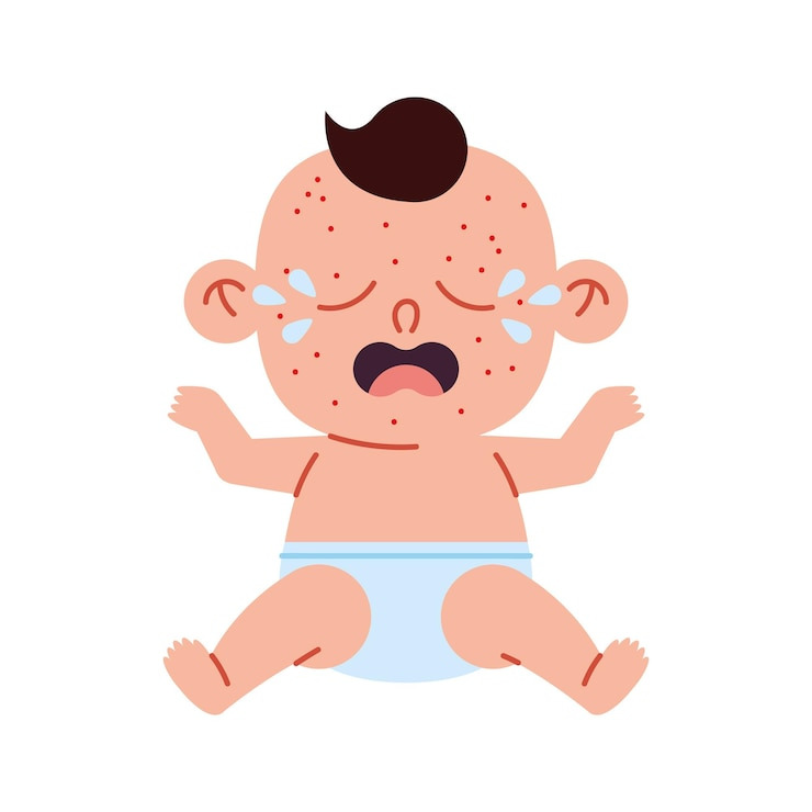 홍역 예방접종