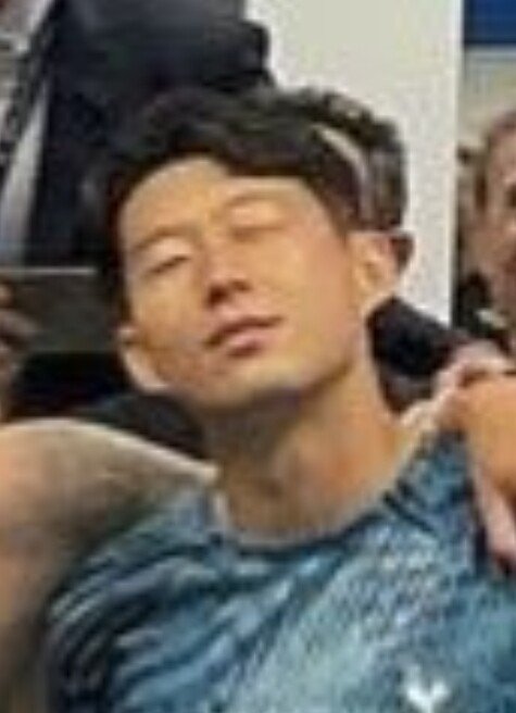 손흥민 부상