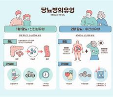 당뇨병 종류