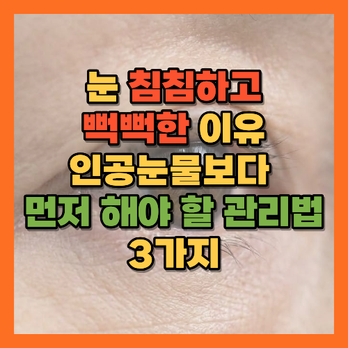 눈침침할때, 눈뻑뻑할때, 안구건조증관리, 온찜질눈, 눈지압법, 202020법칙, 인공눈물, 눈건강관리, 눈피로풀기, 눈꺼풀기름샘, 노년눈건강, 눈건조증자가관리, 눈혈액순환, 안과검진, 마이봄샘, 눈물막안정화, 안구건조증원인, 눈꺼풀온찜질, 찬죽혈태양혈, 오메가3눈건강, 눈건조증증상, 눈깜빡임운동, 디지털눈피로, 콘택트렌즈주의, 눈건강생활습관, 노년안구건조증, 눈피로해소법, 안과진료, 눈건강루틴, 황금길가이드