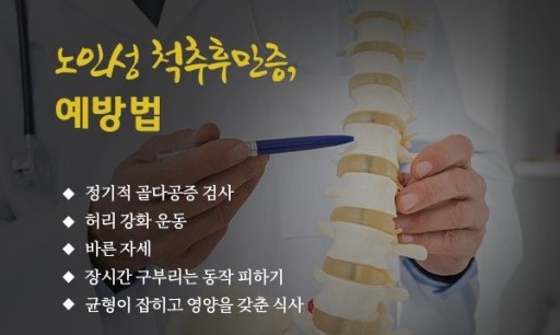 노인성 척추후만증 진단