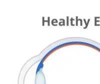 녹내장 초기 증상 &mdash; 시야를 서서히 빼앗는 침묵의 질환