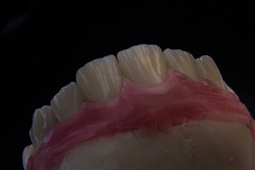 Gums
