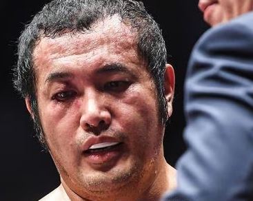 김보성 로드 FC데뷔 안와골절