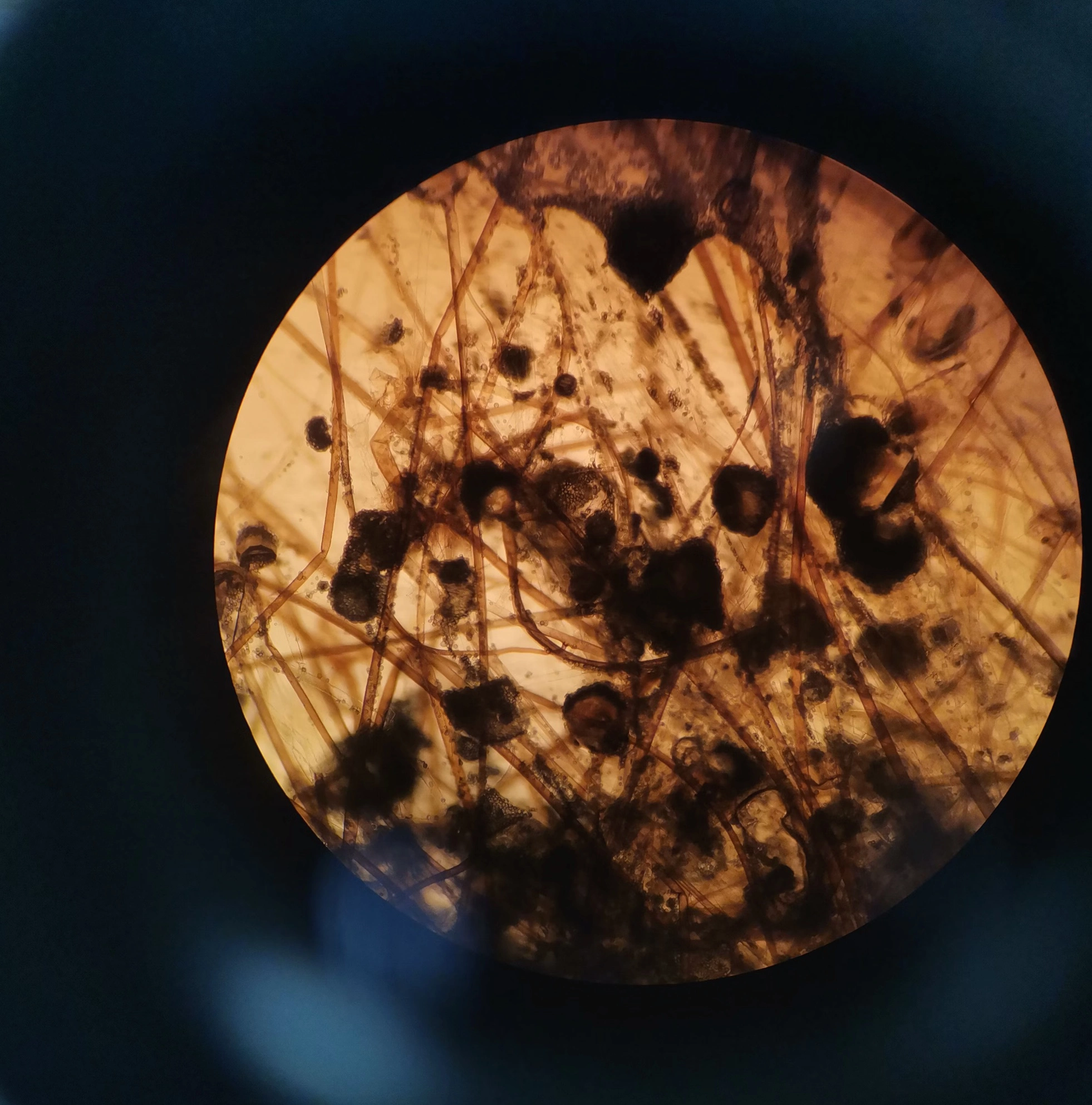 루테인 먹는시간