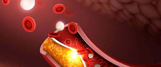 콜레스테롤 낮추는 음식