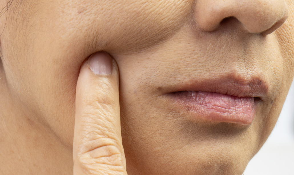 콜라겐부족 시 이미지