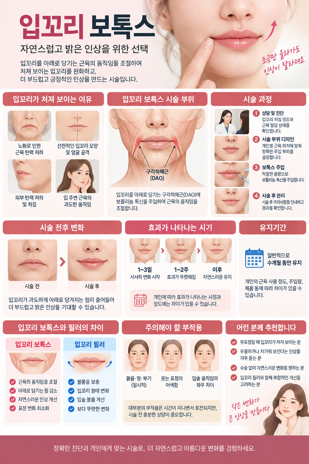 입꼬리 보톡스 자연스런 인상