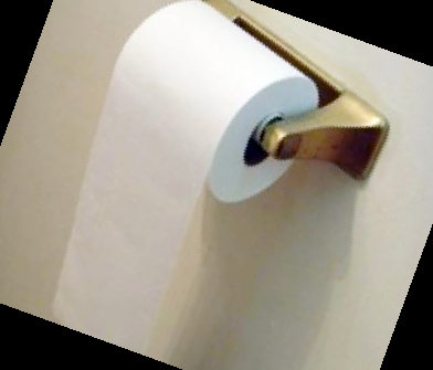 피똥사는 이유 대장암