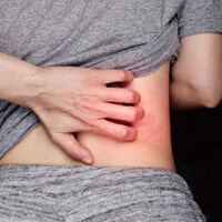 대상포진-때문에-등이-가려운-여성-사진