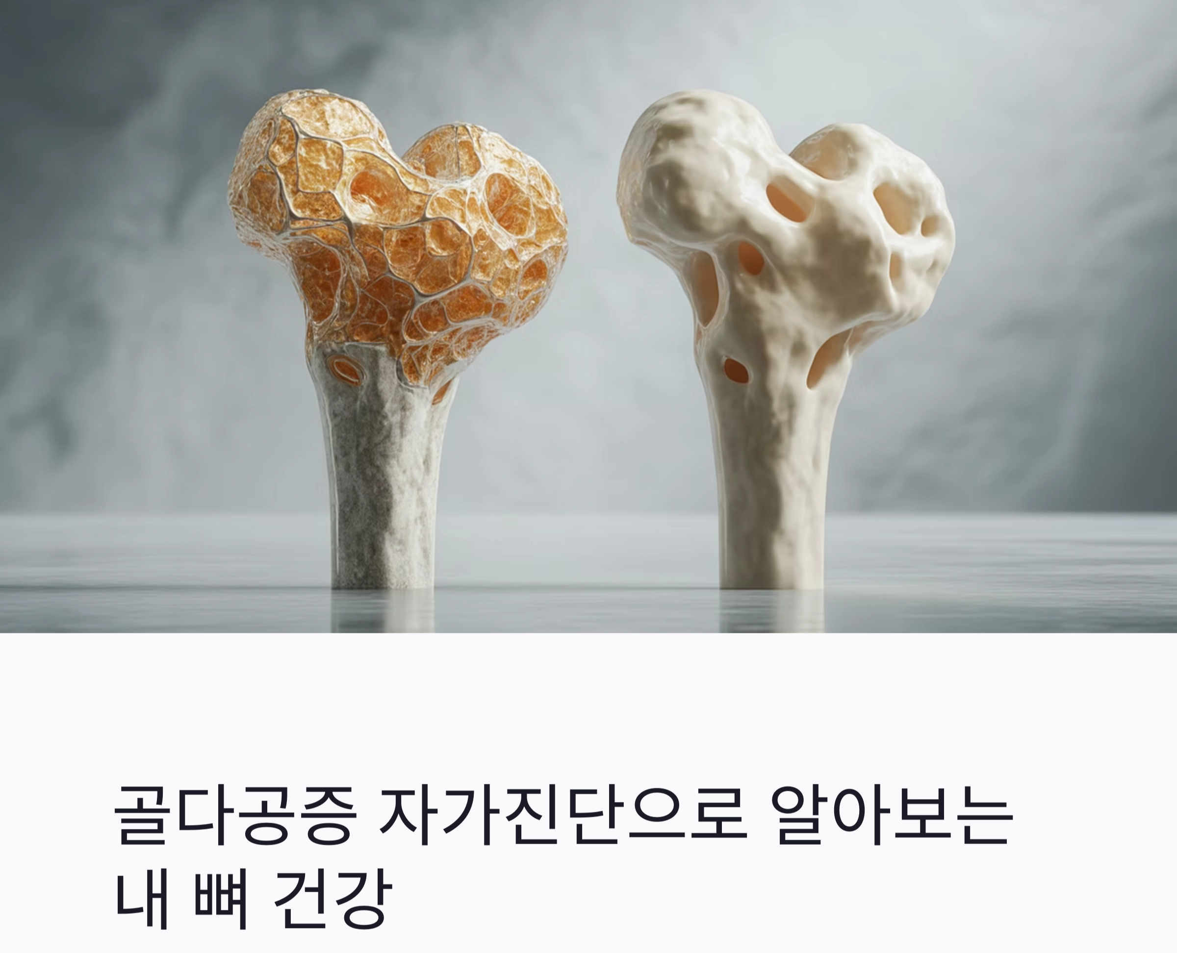 골다공증 자가진단으로 알아보는 내 뼈 건강 위험도