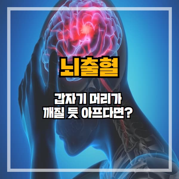 갑자기 머리가 깨질 듯 아프다면? 뇌출혈 의심하세요