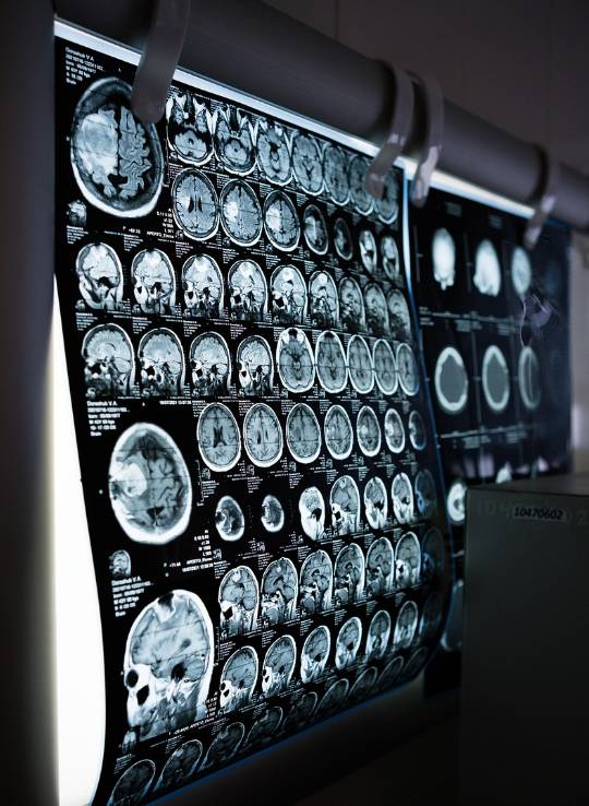 MRI와 MRA의 차이, 활용 사례