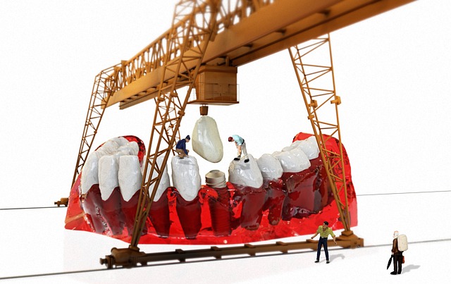 임플란트 가격 비용