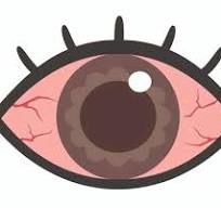 눈이 충혈되는 이유