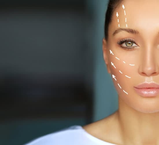 리프팅 시술: 종류, 효과, 부작용