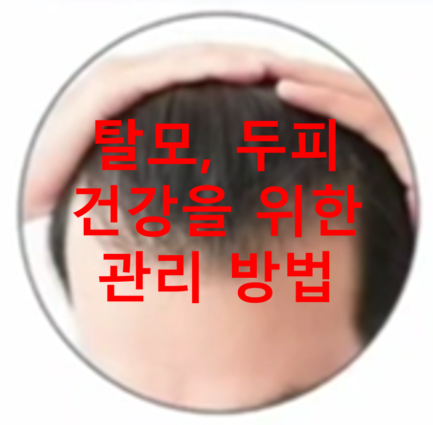 탈모두피