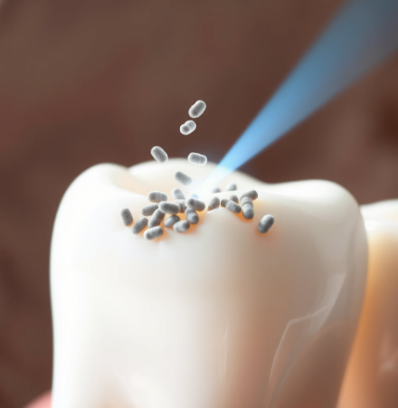 리디에뜨치약-후기-내돈내산-효과-사용법