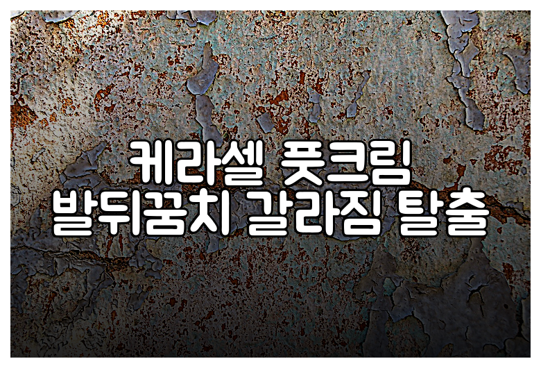 케라셀 풋크림 발뒤꿈치 갈라짐 탈출