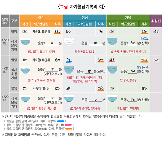 소변 거품(거품뇨)란