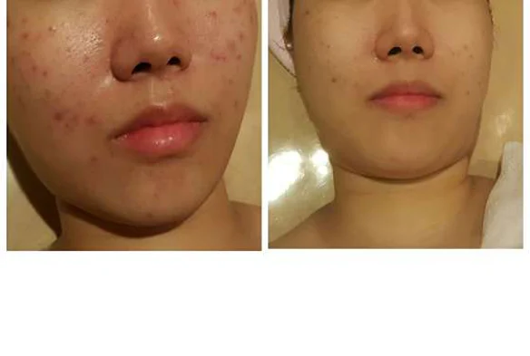 압구정에서 괜찮은하루