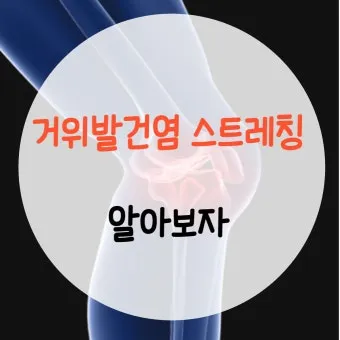 거위발 건염 원인과 증상 무릎 안쪽 통증 치료법 정리_14