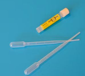 만성 방광염 치료 방법 진단 기준 합병증