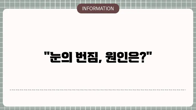 백내장 빛번짐: 