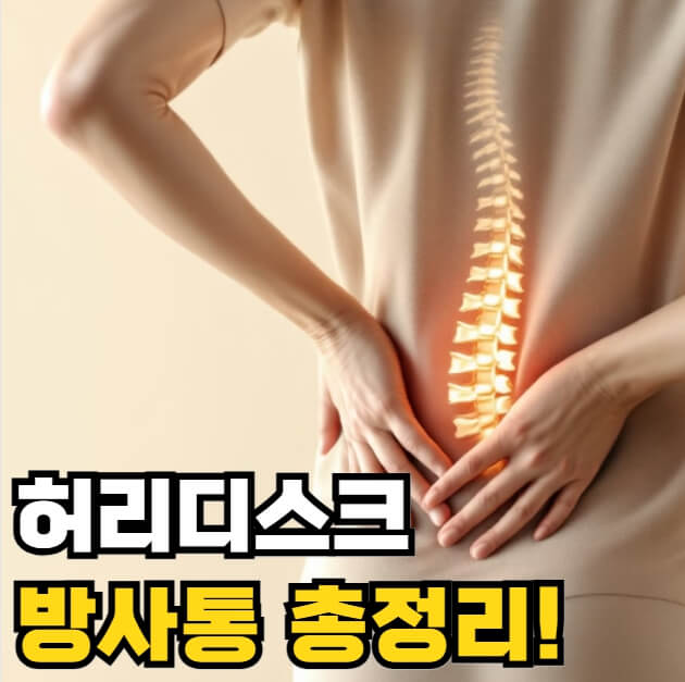 허리디스크 방사통