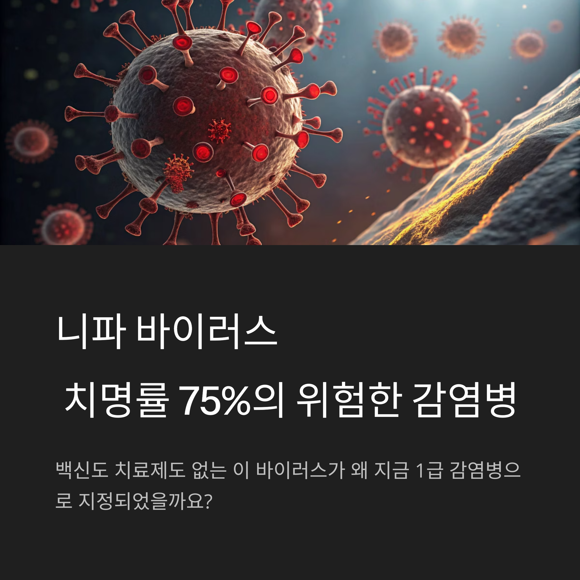 니파 바이러스