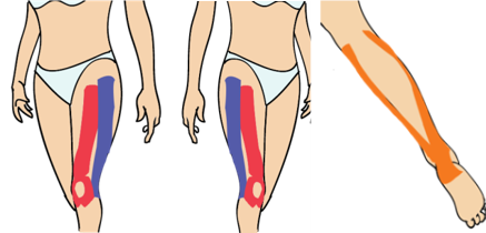 무릎 통증(노화 원인)