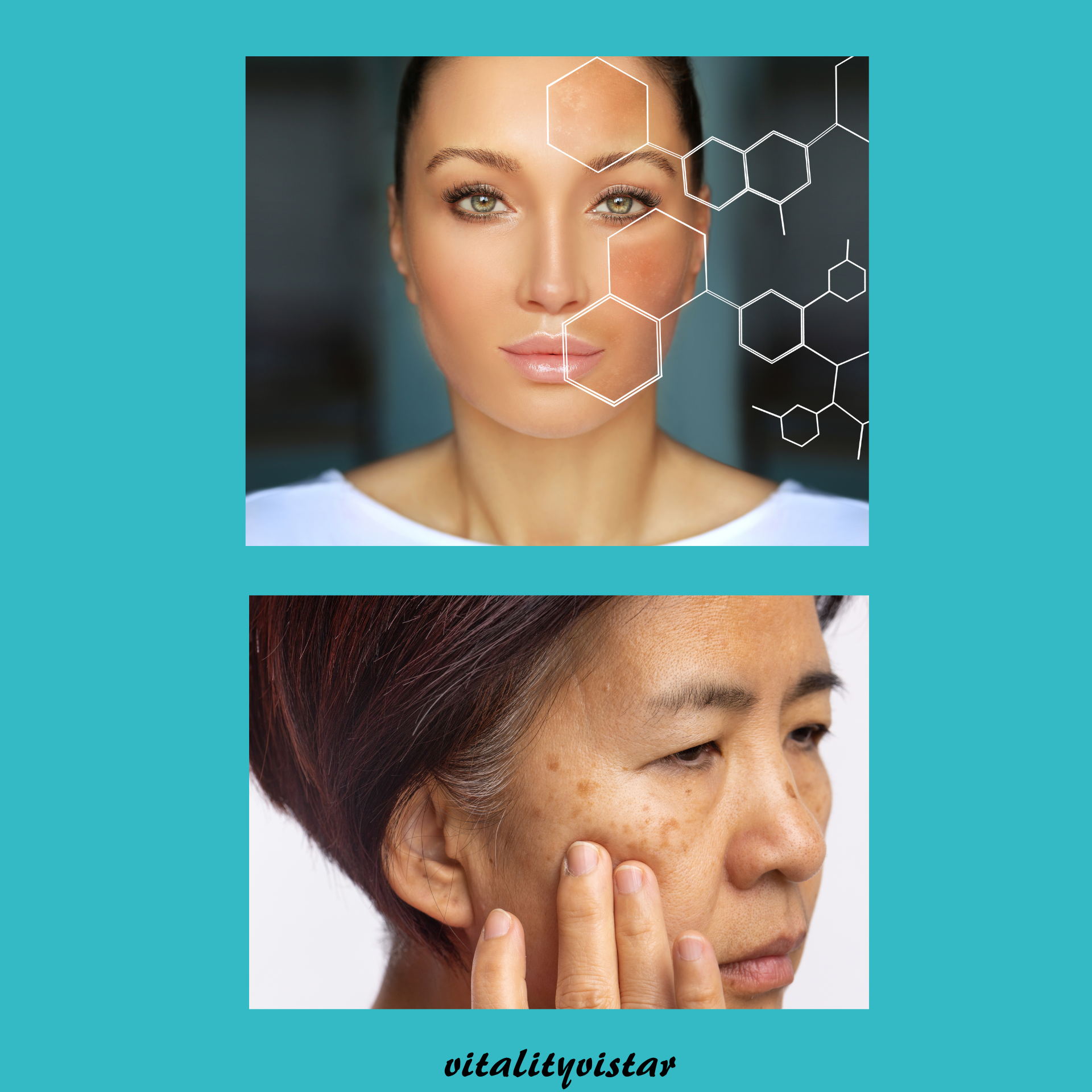 기미와 검버섯, 어떻게 관리할까? 40-50대 여성을 위한 피부 관리 지침