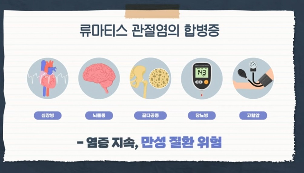 EBS명의-류마티스-관절염-김완욱교수-주지현교수