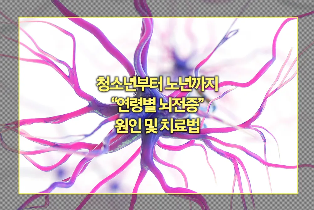 연령별 뇌전증 원인 치료법