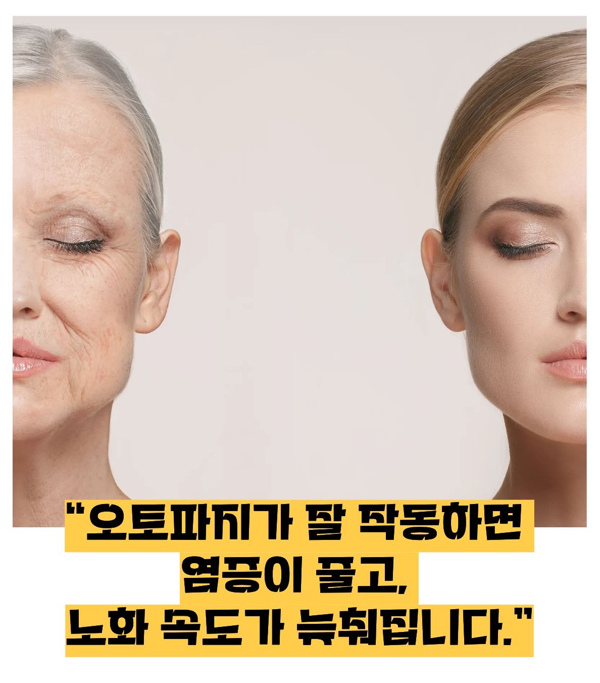 오토파지 뜻