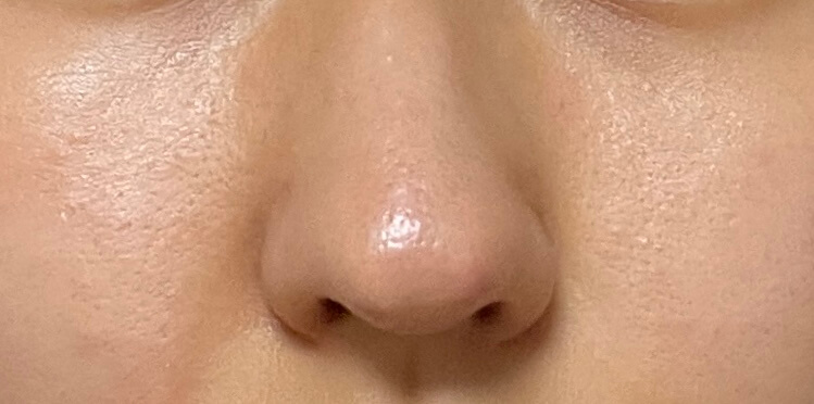 성분에디터 그린토마토 포어리프팅 앰플플러스 사용 2주차(6/18사진)