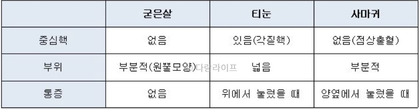 티눈굳은살구분법 티눈 사마귀 굳은살