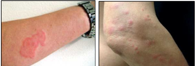 빈대 확인 방법 (주간)