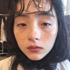 여드름