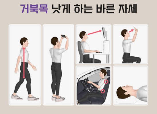 거북목 교정스트레칭 관련사진