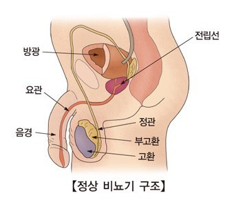 전립선암 초기증상 