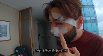 노홍철-부상