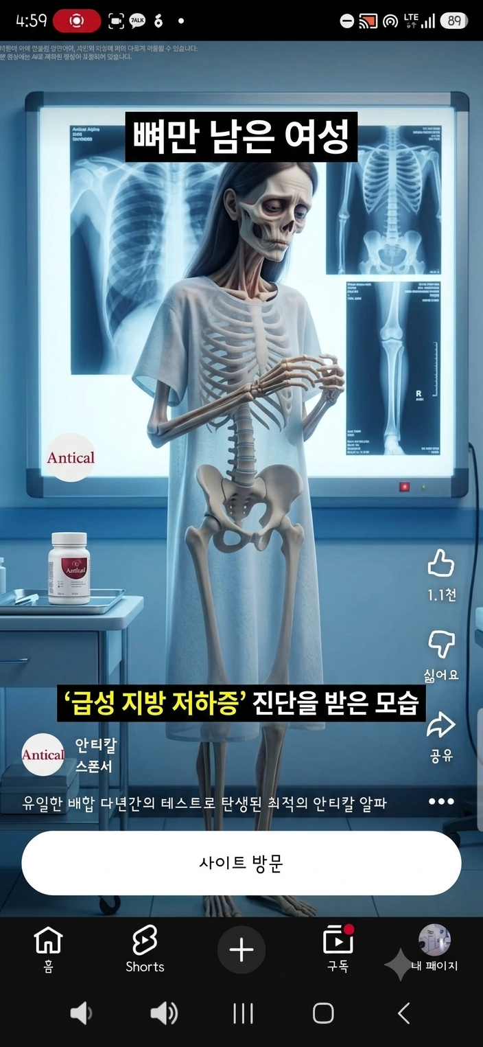 유튜브 광고 스샷, 뼈만 남은 여성 모습