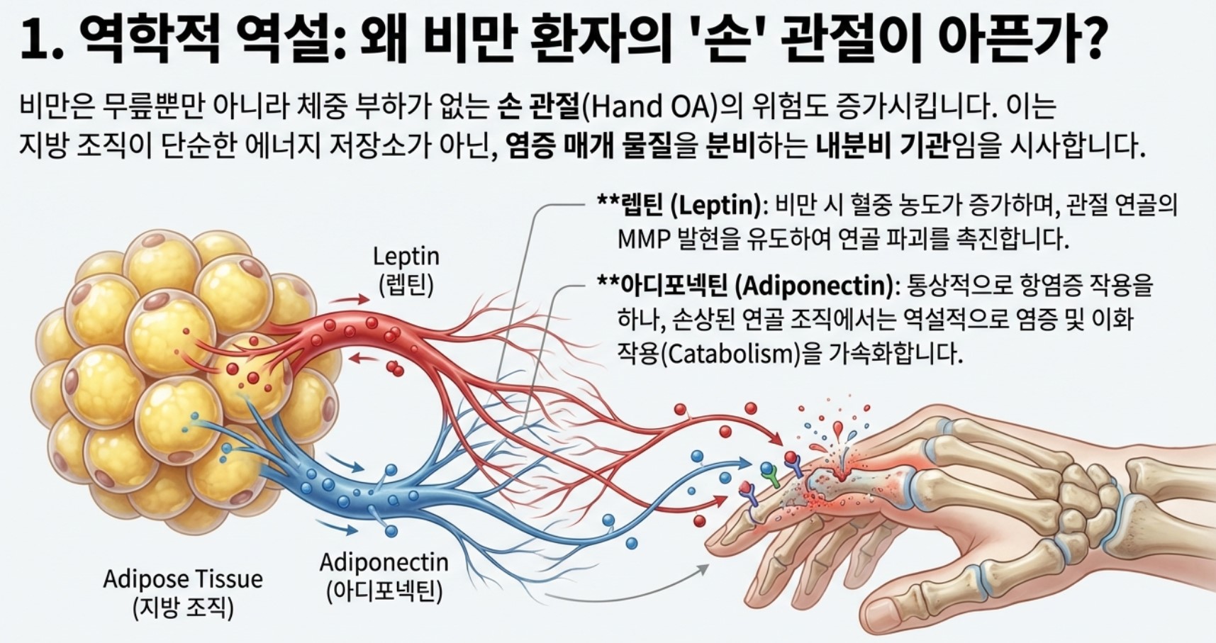 비만인데 손가락 관절염도 많다.