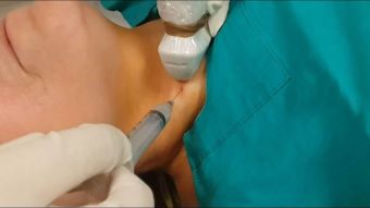 생검 검사 사진