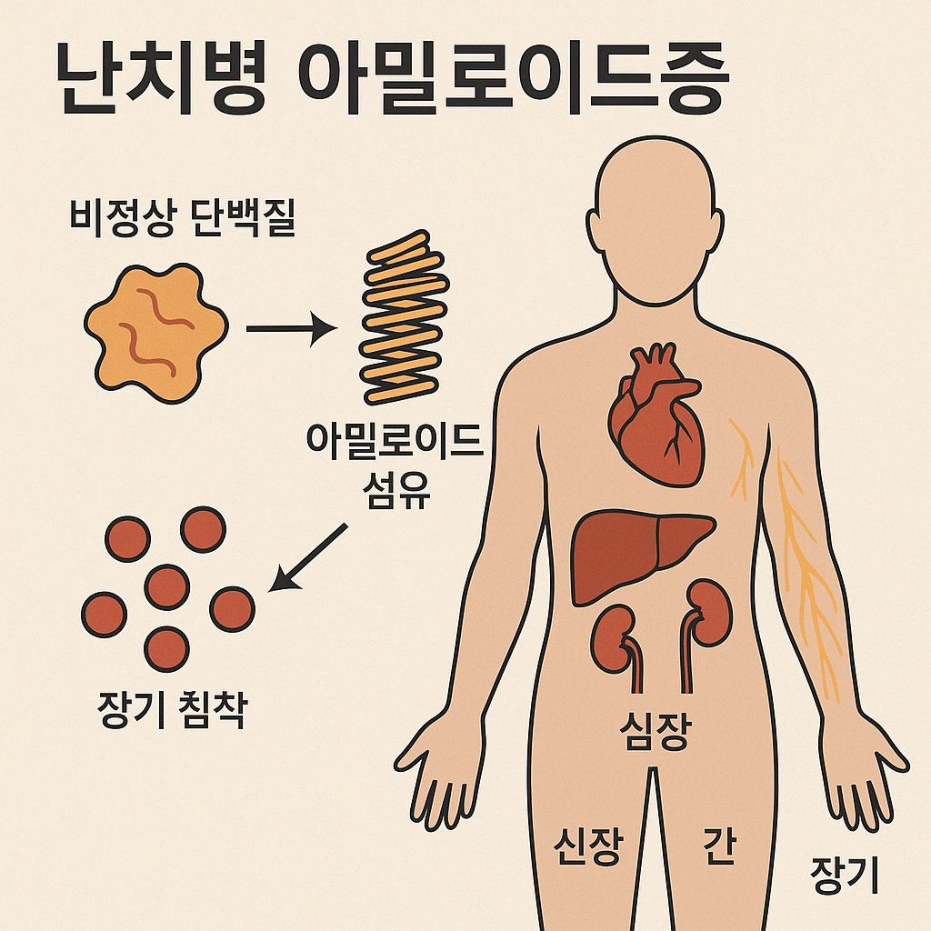 아밀로이드증