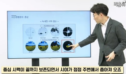 안과명의